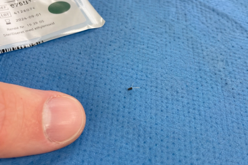 Europa godkender nethinde-implant der giver synet tilbage: Lanceres nu i Tyskland for AMD-patienter